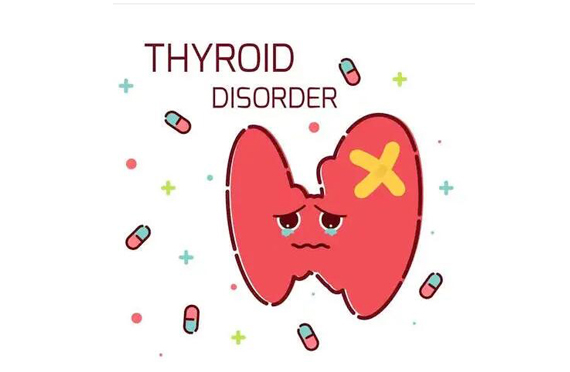  甲状腺结节的原因和预防方法
