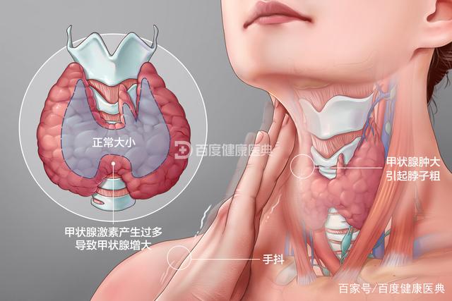 认识甲状腺疾病的古今